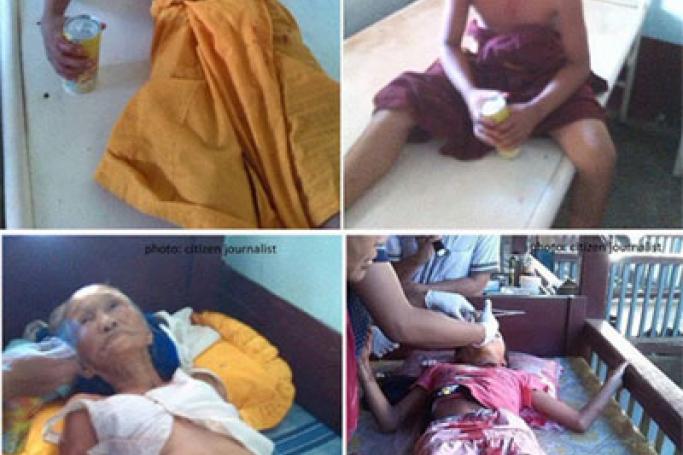 Four victims injured in a bomb explosion in Mong Hsu. Photos: Citizen journalist (S.H.A.N)
