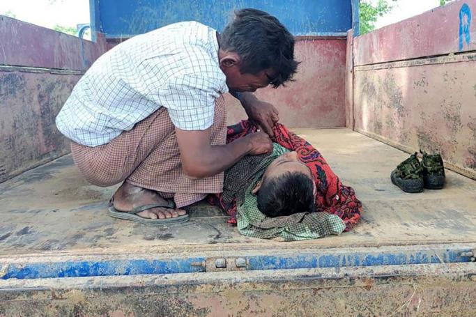 This photo taken on September 17, 2022 shows a young victim of an air strike on a school building in Depeyin township in Myanmar's northwest Sagaing region, a day after an attack on the village by a Myanmar military helicopter. Photo: AFP