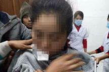 A teacher treated at Laiza hospital, Kachin State. Photo: Gum Ja Naw lahpai/Facebook
