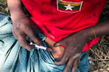 A man wearng a T-shirt with the flag of Myanmar injects heroin into his belly at the Hpakant jade mining area, Kachin State, northern Myanmar, 2 February 2017. Photo: Seng Mai/EPA
